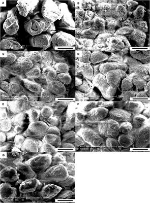 Dietary Palygorskite Clay-Adsorbed Nano-ZnO Supplementation Improves the Intestinal Barrier Function of Weanling Pigs